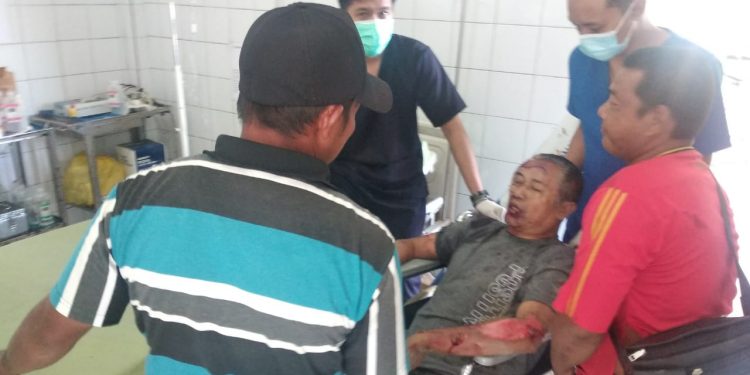 Hindari Aspal Berlobang, Pengendara Sepeda Motor Ditabrak Mobil